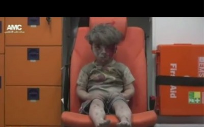 Brother of Syrian boy in haunting image dies of injuries