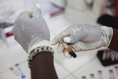 UN health agency issues new guidelines on HIV self-testing