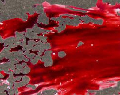 Bus mows down woman in Kolkata, class-V students dies after rammed by dumper in W. Medinipur