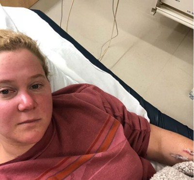 Actress Amy Schumer hospitalised for kidney infection, shares image on Instagram