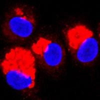 Natural lipid acts as potent anti-inflammatory: Study