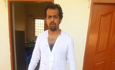 Pakistani journalist attacked by unknown men in Islamabad, escapes kidnapping attempt