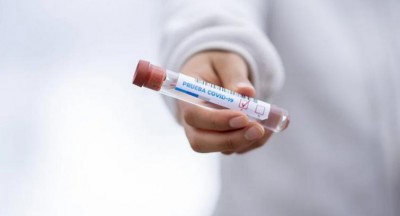 Bangladesh records 37 fresh Corona deaths