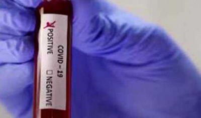 COVID-19: 1178 new positive cases reported in AP