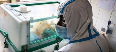 Côte d’Ivoire confirms first Ebola case in 25 years