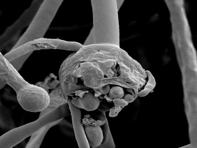 Centre asks states to declare Black Fungus Disease an epidemic