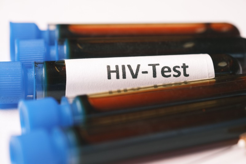 Karnataka colleges will host voluntary HIV testing camps as infections rise among students and adults.