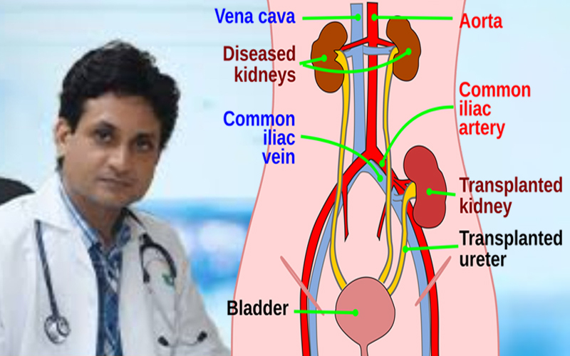 Optimising Post-Kidney Transplant Health: Does one need to change the diet?