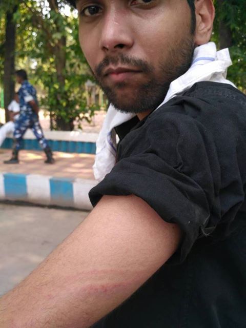 Kolkata Police lathicharge journalists