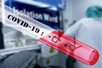Assam to conduct 50,000 random tests for COVID-19 to check community transmission