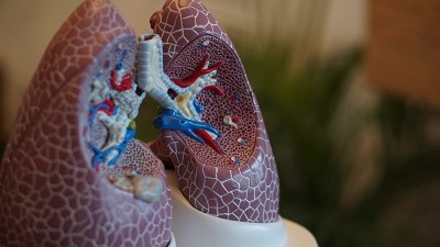 Lung cancer survival rates are improving for everyone: American Lung Association