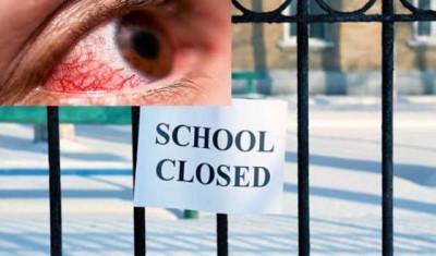 Arunachal: Authorities order closure of schools in Itanagar following conjunctivitis outbreak