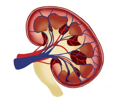 IT employees suffer from kidney stones due to work conditions, warns expert