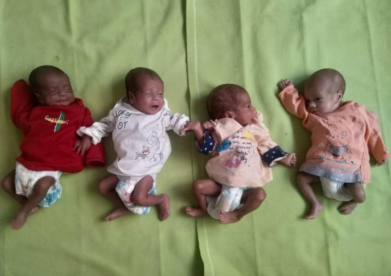 Jammu: Doctors manage birth of premature quadruplet