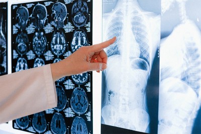 India develops cost-effective handheld X-ray for TB screening