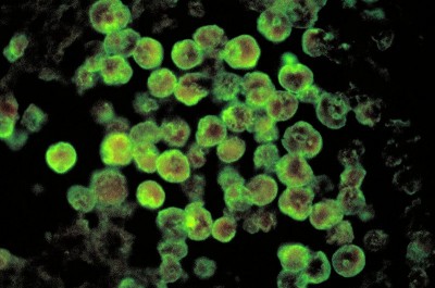 Pakistan: 22-year-old man dies in Karachi after being infected by brain-eating amoeba